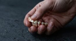 dreams of losing teeth